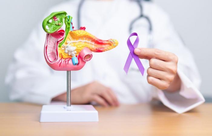 This symptom is the first to appear when you have pancreatic cancer