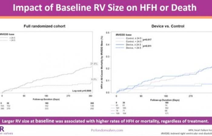 Reshaping of the right heart after tricuspid repair by TriClip