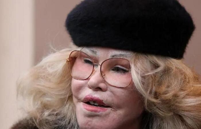 ‘Catwoman’ Jocelyn Wildenstein, 84, Spotted in Paris Displaying Smooth Complexion after Insisting She’s ‘Never’ had Plastic Surgery Despite Drastic Transformation