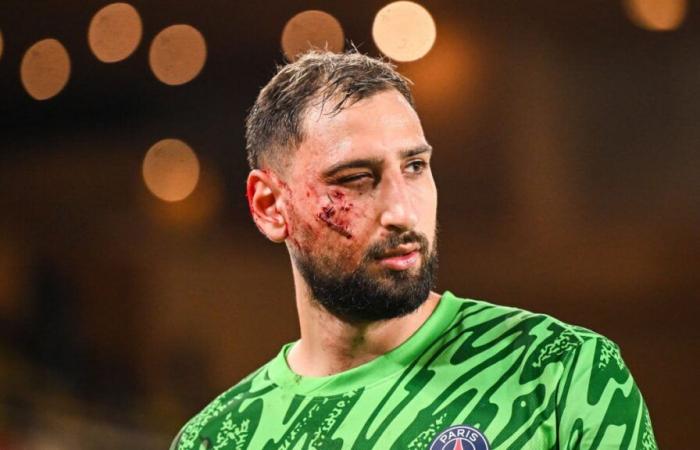 Bloodied, a PSG player is disfigured in the middle of a match