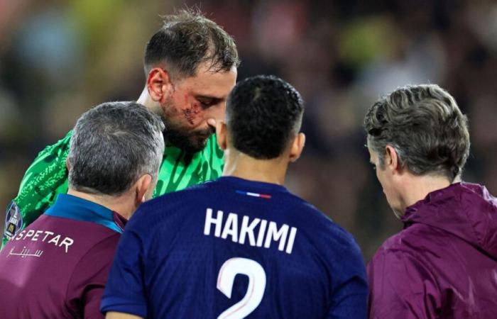 PSG keeper Donnarumma bloodied by cleat to the face