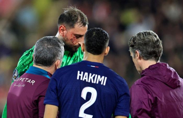 Gigi Donnarumma’s face bleeds with nasty gash before being stapled together from horror studs-up challenge