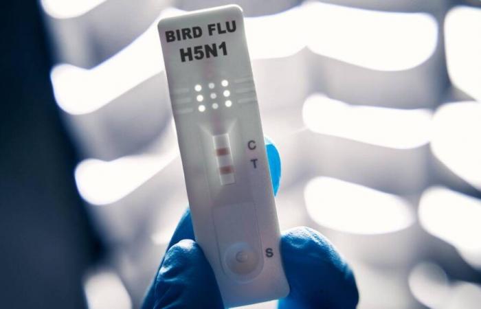 First serious case of bird flu in humans detected in the United States