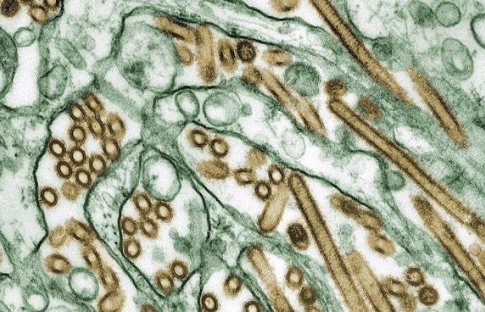 The United States confirms first serious case of avian flu in humans