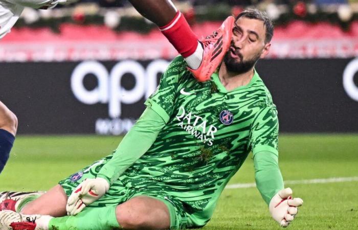 “You are more beautiful like that”, Donnarumma chambered by his teammates after his facial injury