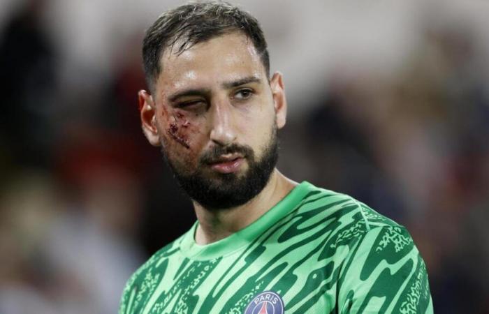 Donnarumma injury, no card for Singo: controversy over the referee’s decision