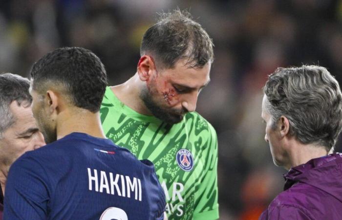 “When it’s like that, it’s red,” says former referee Bruno Derrien after Gianluigi Donnarumma’s facial injury