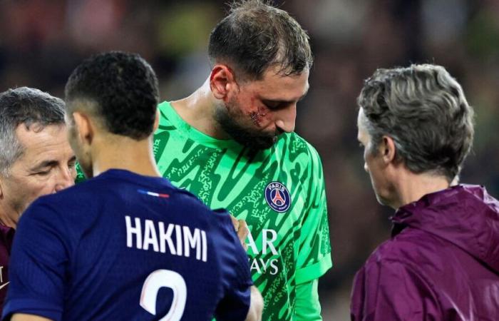 “Now you are more beautiful”: Donnarumma chastised by his PSG friends after his facial injury