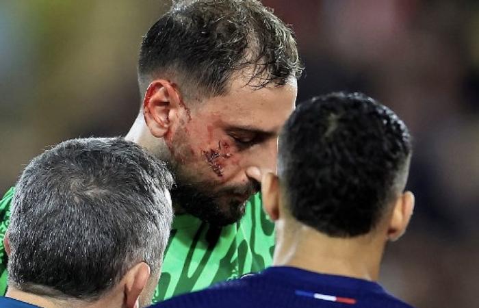 Donnarumma has a devastated face, shocking images. Le Parisien: “Singo wasn’t even booked”