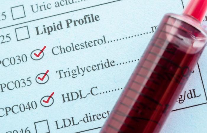 DEMENTIA: Bad cholesterol helps explain it