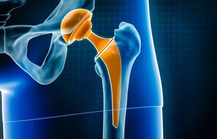 partial suspension and strengthening of patient monitoring