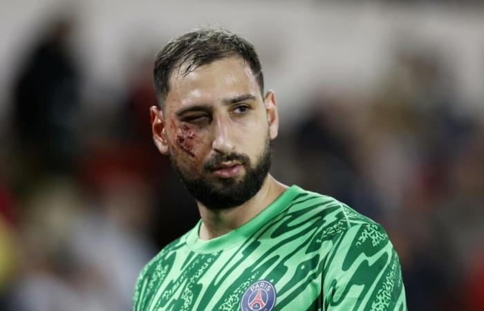 Injury for Donnarumma, several stitches to his face after a clash with Singo