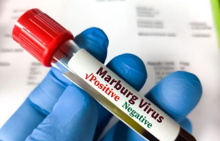 Marburg virus disease outbreak in Rwanda declared over