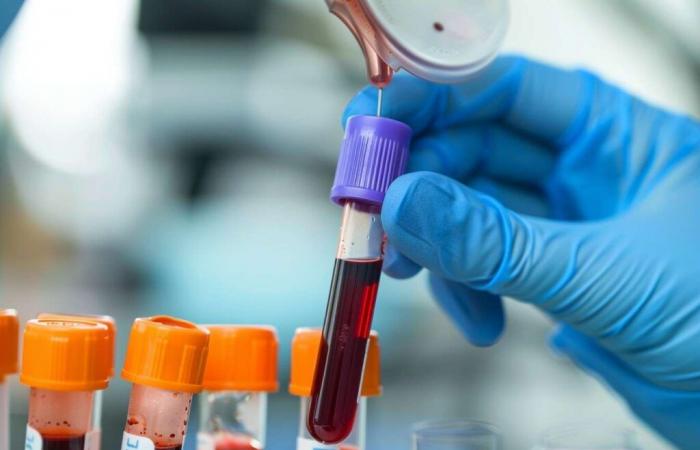 Revolutionary blood test could detect dementia before symptoms appear