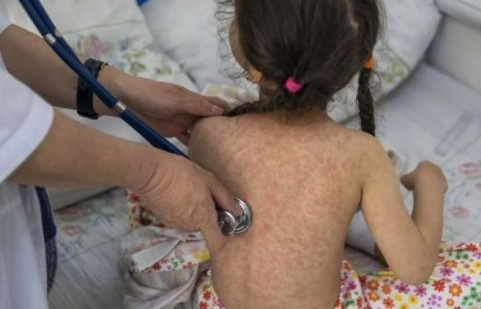 Resurgence of measles in Cambodia in 2024