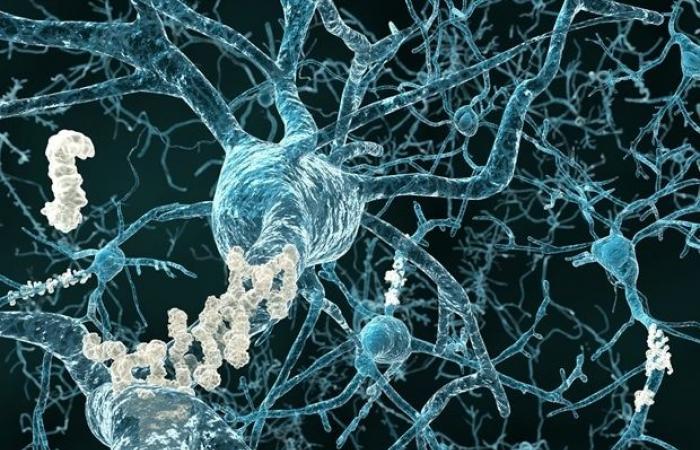 Researchers identify key mechanism linking brain stress to Alzheimer's disease