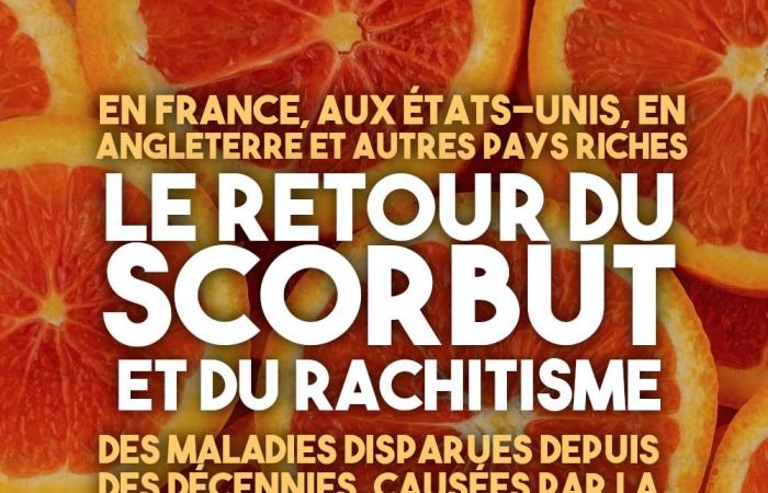 The return of scurvy in rich countries – Counter Attack