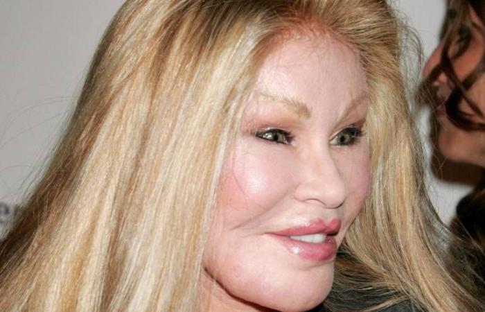 Death in Paris of the “cat woman” Jocelyn Wildenstein, a jet-set figure known for her numerous cosmetic surgery operations