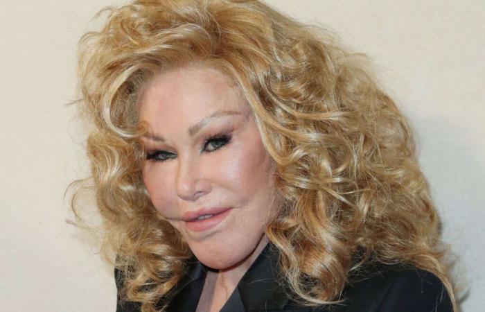 Jocelyn Wildenstein, jet-set figure, nicknamed the “cat woman”, died in Paris