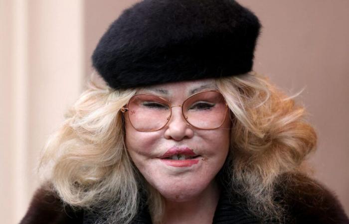 Jocelyn Wildenstein dead: ‘Catwoman’ socialite known for extreme plastic surgery dies aged 84