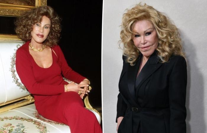 Jocelyn Wildenstein, “Catwoman”, dies at 84