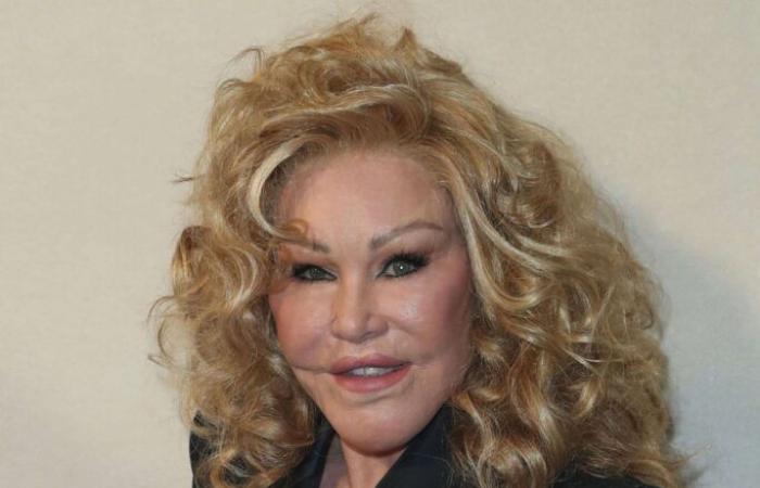 Death of Jocelyn Wildenstein, the “cat woman” of the jet-set