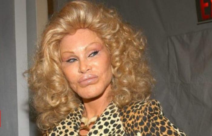 Swiss socialite Jocelyne Wildenstein, known as ‘catwoman,’ passes away at 79