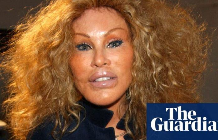 Jocelyne Wildenstein, socialite known for extreme cat-like plastic surgery, dies at 84 | Paris