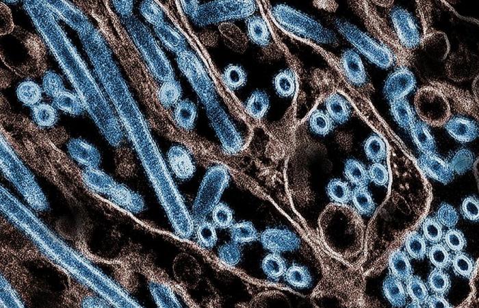 British Columbia | Teenager with bird flu no longer contagious