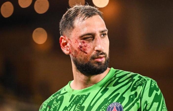 Donnarumma's impressive scar on her face