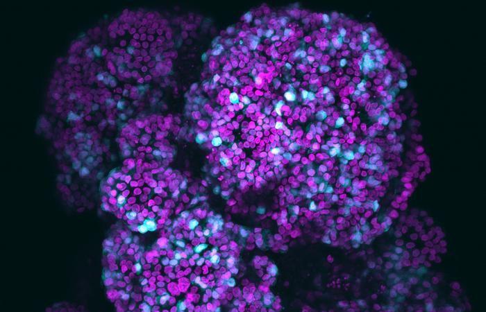 First functional pancreatic organoids with three cell types: a major breakthrough