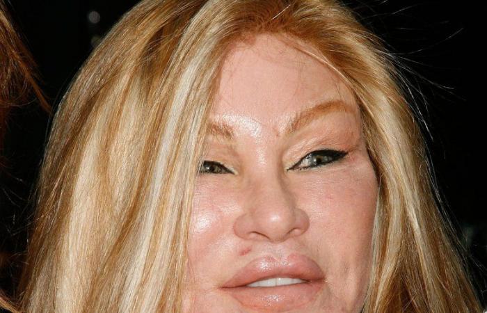 “You have to be careful to have the right surgeon”: what operations did Jocelyne Wildenstein, nicknamed the “cat woman” undergo?