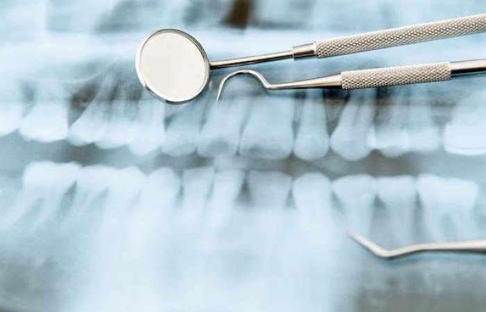 Retired federal civil servants demand better dental coverage