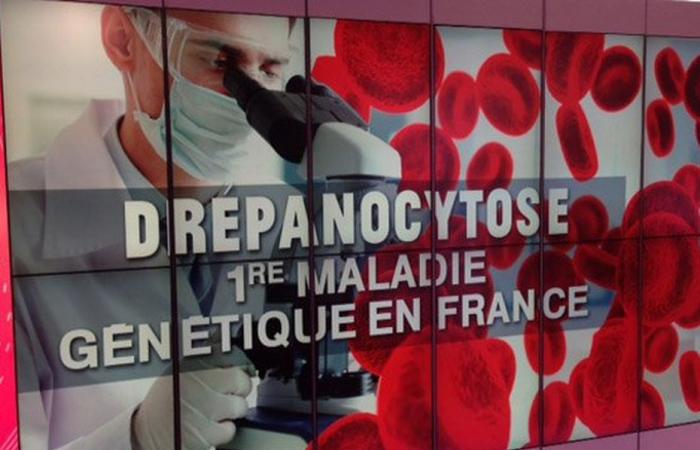 traveling consultations announced for patients followed for sickle cell anemia and other metabolic diseases in Mayotte