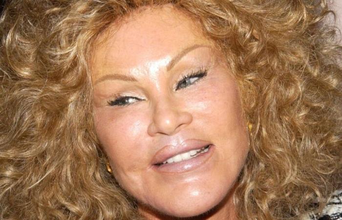 Jocelyne Wildenstein, Socialite and Tabloid ‘Catwoman,’ Dies at 79