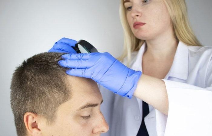 Alopecia pathologies of the scalp: recognize them, treat them