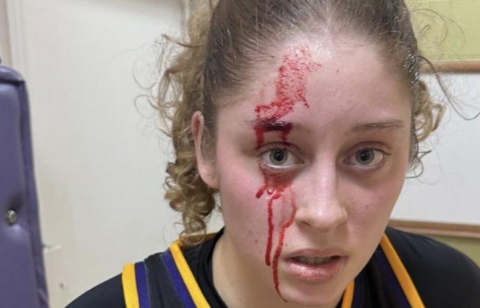 Basketball: the daughter of this tennis legend finishes her match with 40 points… and a bloody face