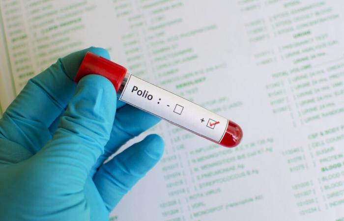 The polio virus is present again in Europe