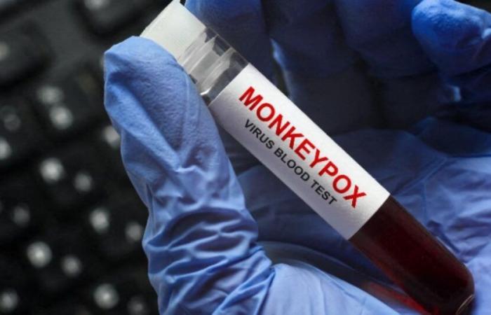 Monkey pox: a first case of the new variant identified in France: News