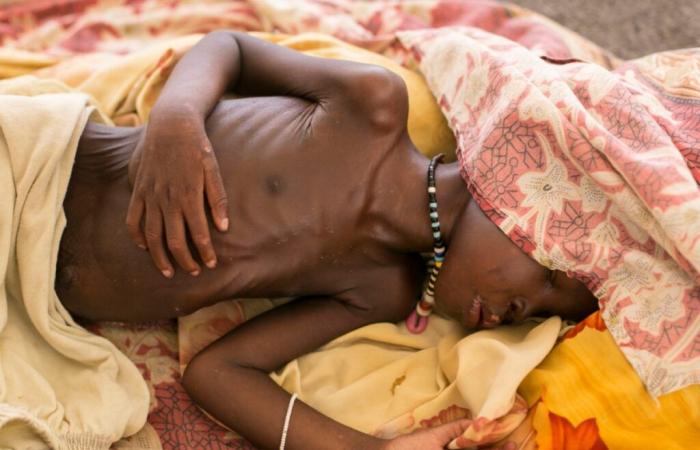 Sudan: 3.2 million children at risk of malnutrition