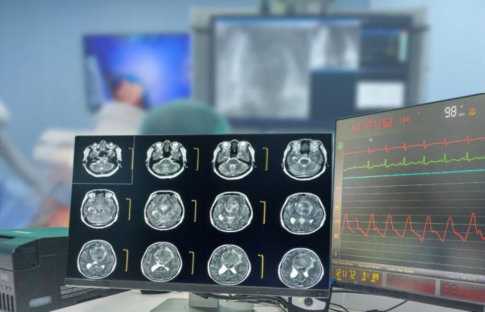 GLIOBLASTOMA: Preventing the escape of this deadly brain tumor