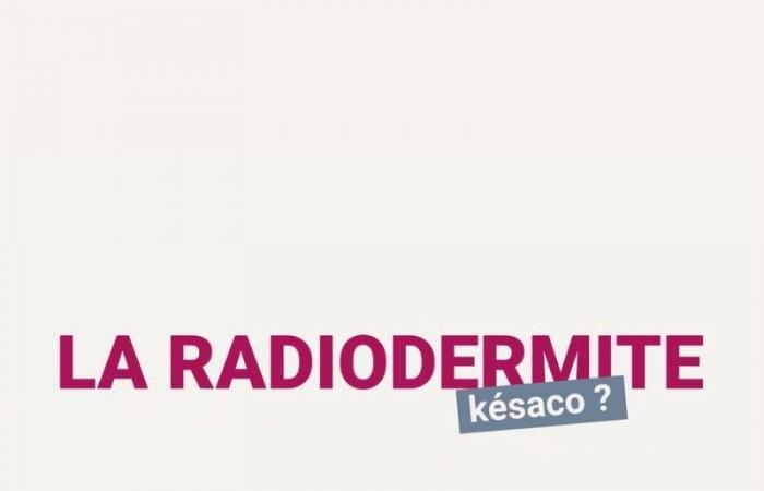 La Minute du Dr RoseUp – Radiodermatitis, kesako? – RoseUp Association %