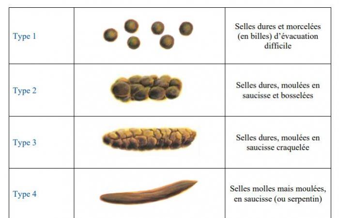 Demystifying science | Saddles in the hot seat