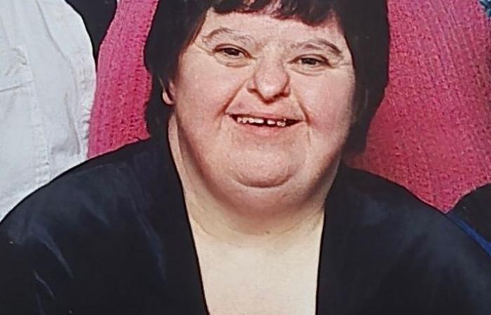 Suffering from Down syndrome | Sister of woman who died of starvation calls for systemic changes