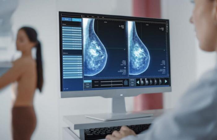 Health. Artificial intelligence could revolutionize breast cancer screening