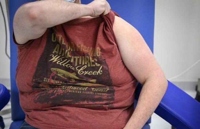 Obesity should be diagnosed differently, experts say