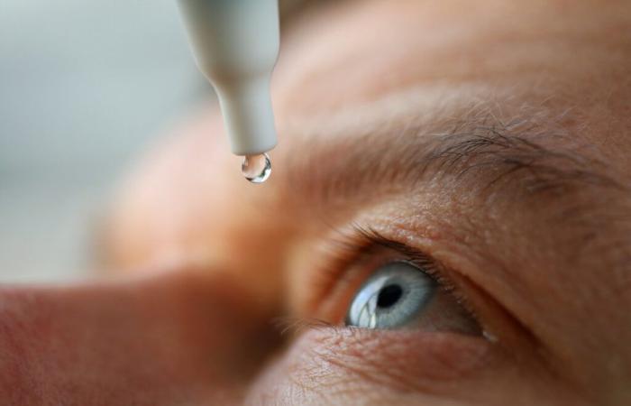 Researchers develop eye drops to treat dry AMD