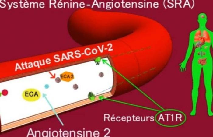 Major advances in the treatment of cardiovascular diseases