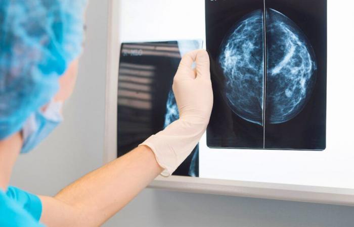 AI increases breast cancer detections by 18%