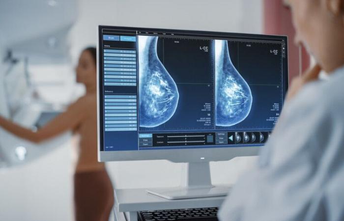 Less radiation is needed for people with non-metastatic breast cancer